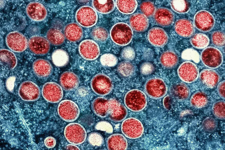 Sierra Leone declares emergency over mpox outbreak