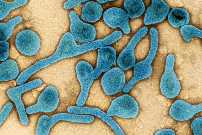 Tanzania: At least 8 dead in suspected Marburg outbreak – WHO
